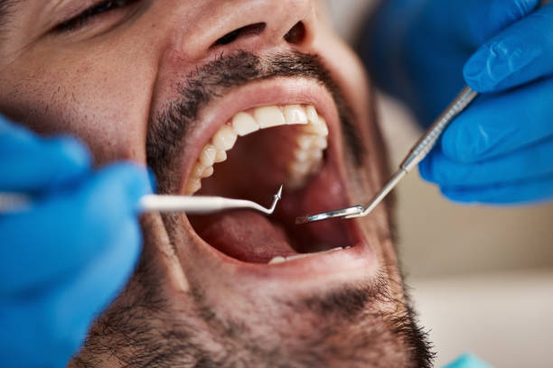 Best Emergency Dental Services for Seniors in Donalsonville, GA